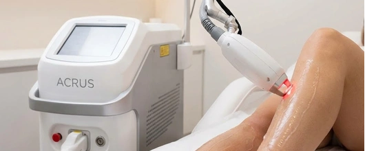 Depilação a Laser em Atibaia